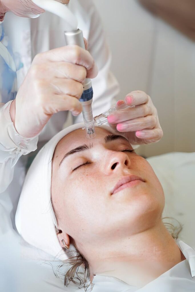 A relaxed client undergoing a facial microneedling procedure performed by a dermatologist.