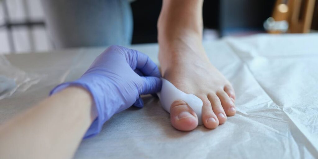 A healthcare professional wearing purple gloves fitting a toe spacer on a patient's foot with visible bunions.